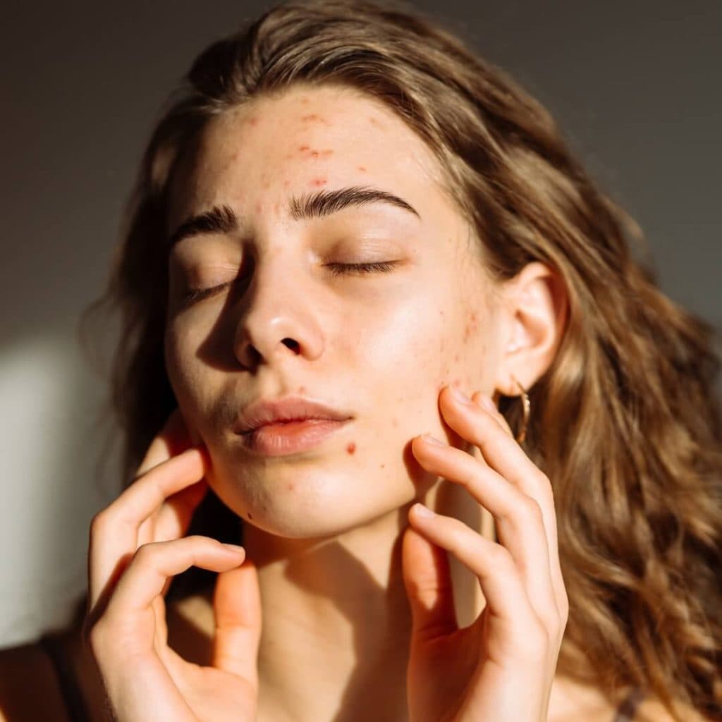 Photo from Beacon Dermatology's website