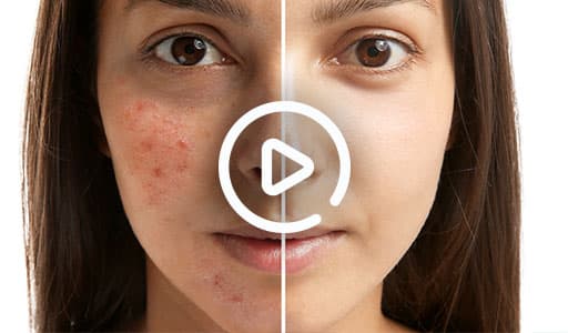 Photo from SFP Medispa Toronto (Solomon Facial Plastic)'s website
