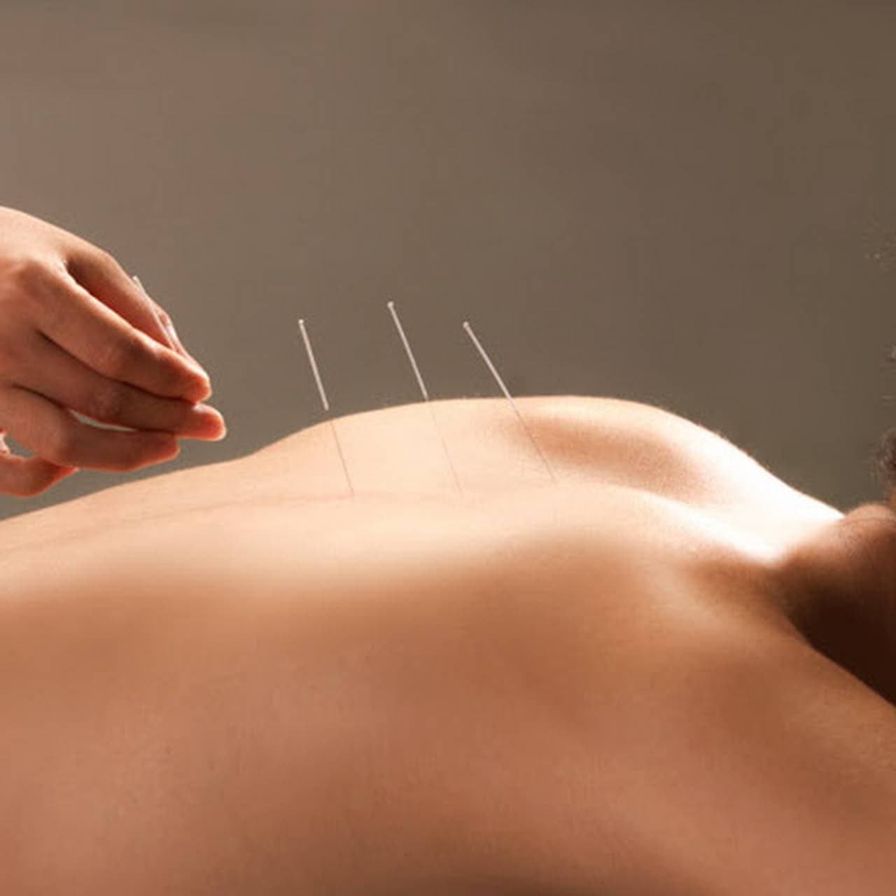 North Shore Acupuncture gallery image 5