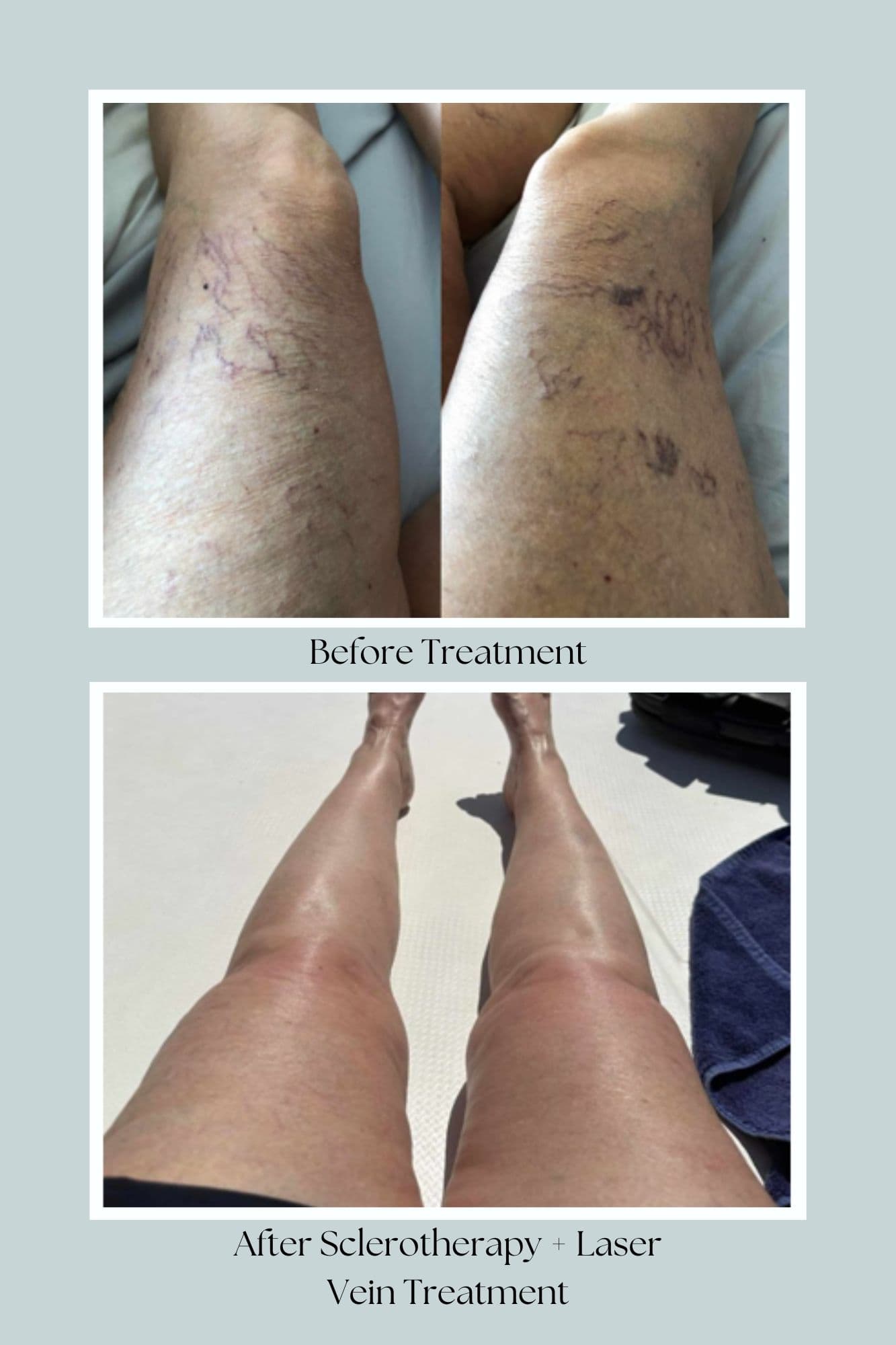 ReNew Medical Laser & Skin Care Aesthetics Inc. gallery image 1