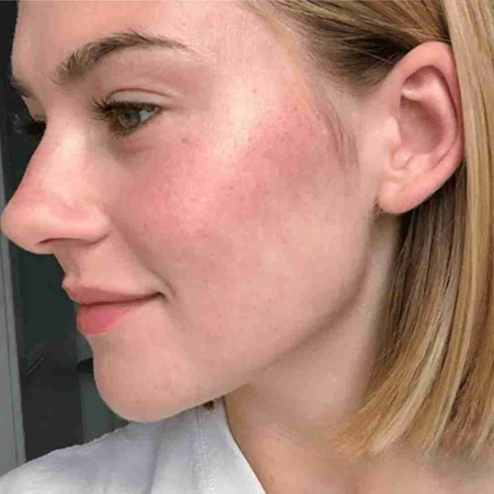 Skin Focus Regenerative Medicine gallery image 3