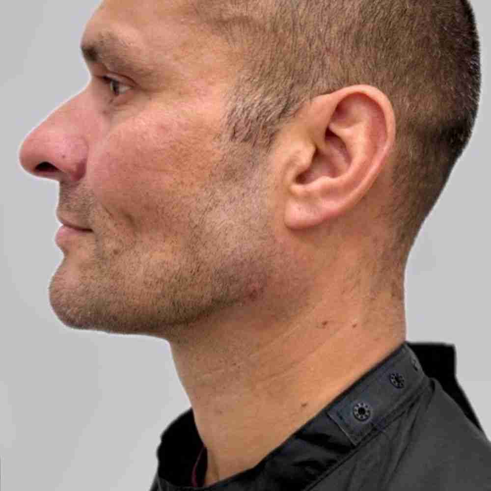 Skin Focus Regenerative Medicine gallery image 5