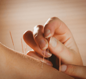 Galt Physiotherapy & Acupuncture gallery image 5