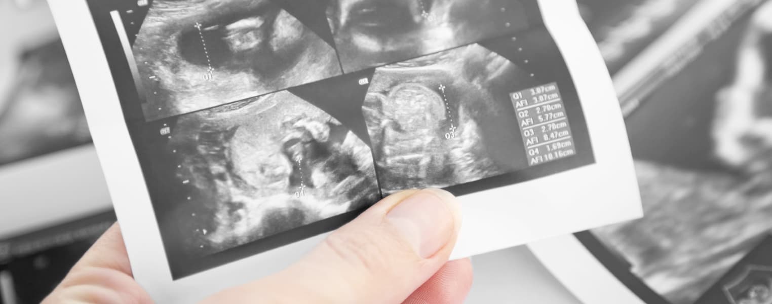 Clinique de Gynécologie et Obstétrique Pierre-Boucher gallery image 2