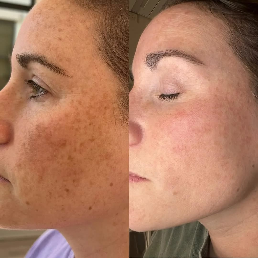 Elite Laser gallery image 5