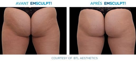 Kinésolution gallery image 3