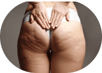 Institut Conscience | Remodelage Corporel • Endermologie • Vanquish Me • Microneedling gallery image 4