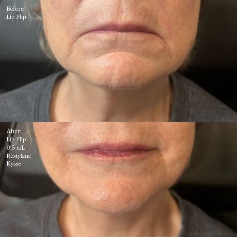 MD Treatment Lounge - Aesthetic Medicine, Botox & Fillers, PRP, Acne & Skin Care, Weight Loss & Lifestyle Medicine gallery image 5