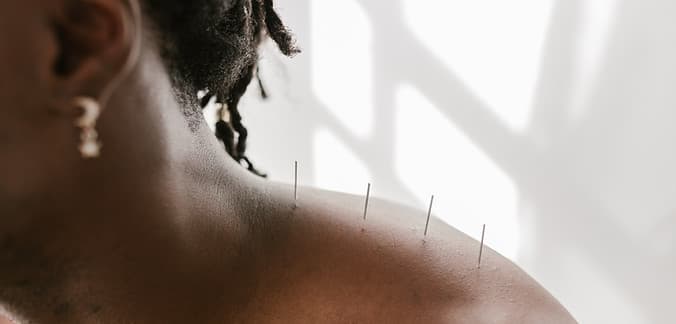 JK Balance Acupuncture and Herbs Clinic LTD | Johnkim Acupuncture gallery image 5