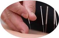 Acupuncture Chinoise Zhi Fang Zhai (Lily) gallery image 4