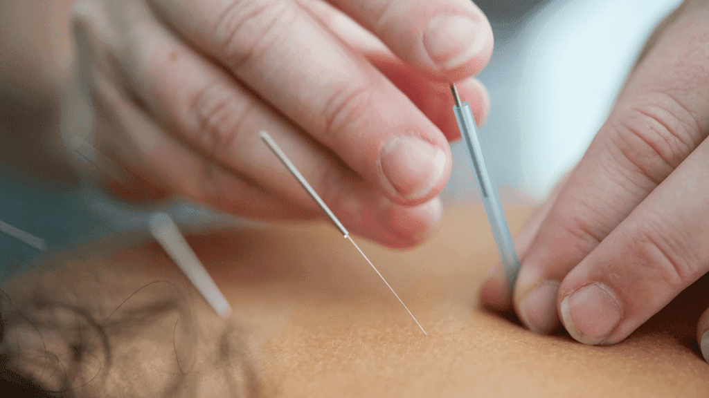 AcuMaster Acupuncture and TCM Healing Centre 仁一堂 gallery image 2