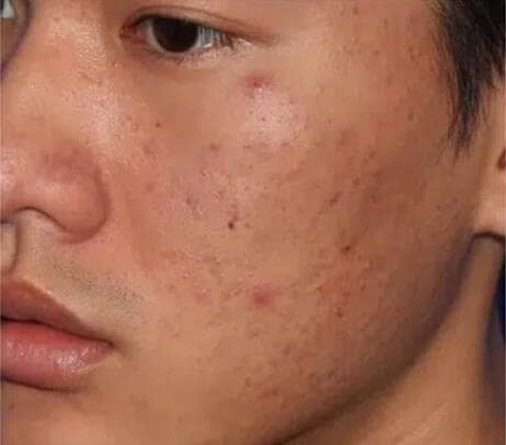 Red Lotus Spa & Laser Hair Removal gallery image 3