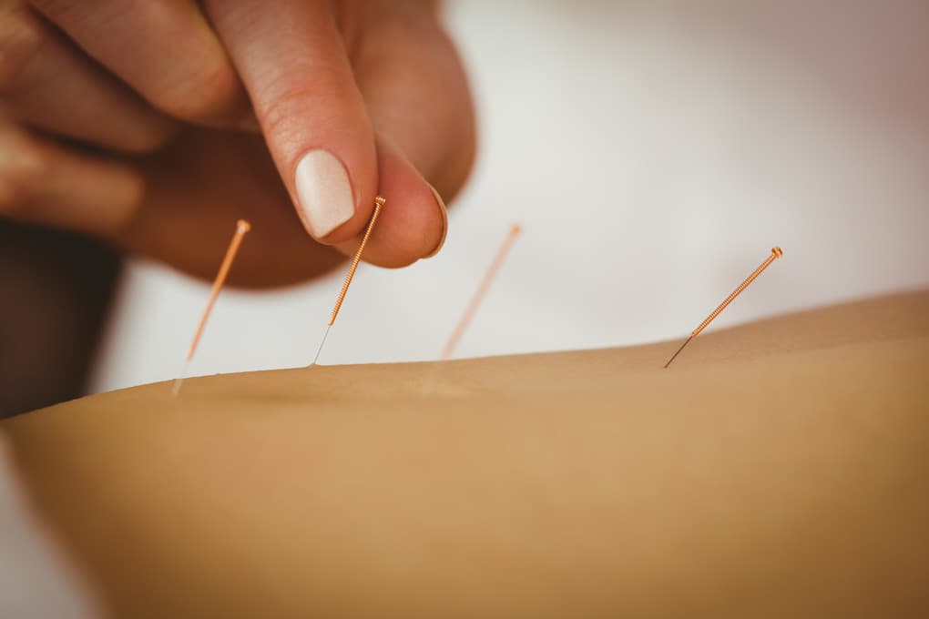 Zahra Acupuncture Clinic